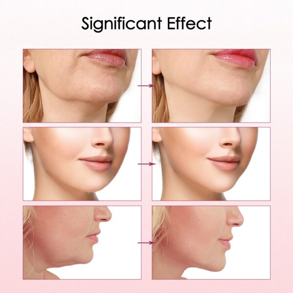 Double Chin Facial Massage Electric V Face Massager - Image 3